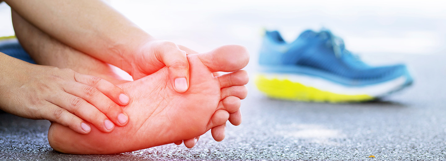 5 mitos sobre el pie de atleta (imagen)